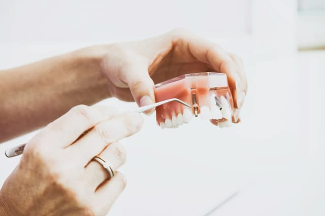 How Much Do Dental Implants Cost & How Long Do They Last? 2025 Guide